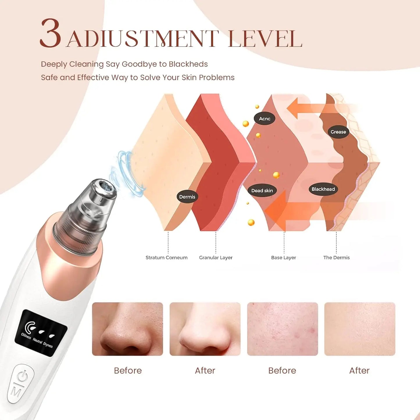 Newest Technology Blackhead Remover Vacuum Pore Cleaner for Face&Nose Blackhead Removal Kit Electric Acne Facial Extractor Tool