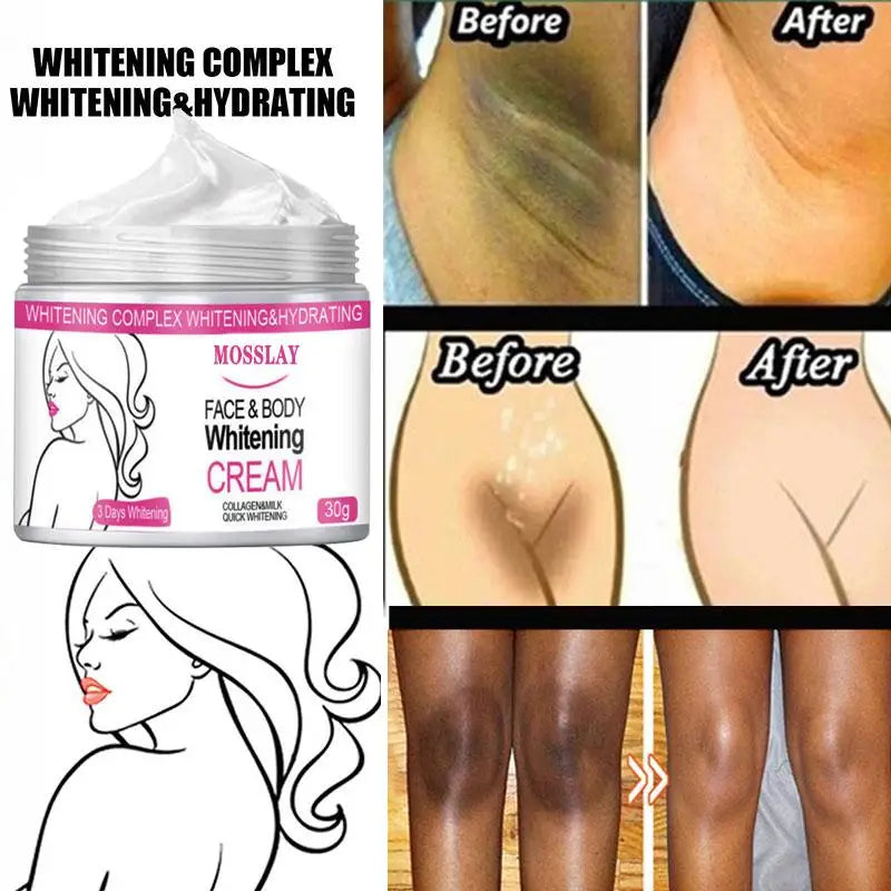 Whitening Cream Face Body Moisturizer Illuminate Dark Skin Neck under Arms Armpit Bikini Private Part Knees Elbow between Legs