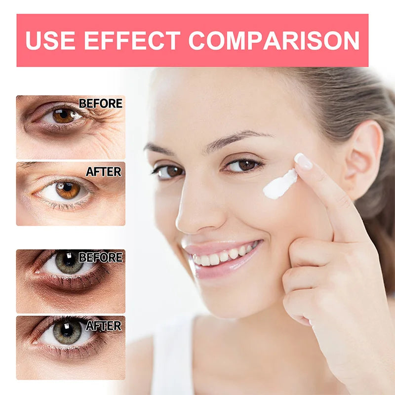 Retinol anti Wrinkle Eye Cream Removing Eye Bags Dark Circles Preventing Puffiness Brightening Whitening Moisturizing Skincare