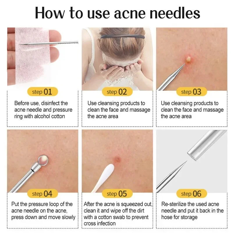 11Pcs Acne Needle Blackhead Clip Remover Extraction Pore Black Head Clean Face Skin Care Cleansing Needle Blemish Removal Tool